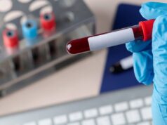 Desarrollan prueba de sangre para detectar cáncer de páncreas en minutos
