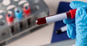 Desarrollan prueba de sangre para detectar cáncer de páncreas en minutos