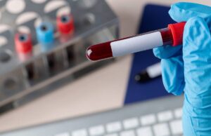 Desarrollan prueba de sangre para detectar cáncer de páncreas en minutos