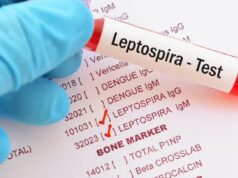 RD registra 19 muertes por leptospirosis en lo que va de 2026