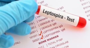 RD registra 19 muertes por leptospirosis en lo que va de 2026