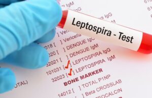 RD registra 19 muertes por leptospirosis en lo que va de 2026