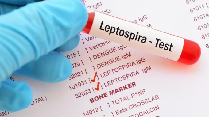 RD registra 19 muertes por leptospirosis en lo que va de 2026